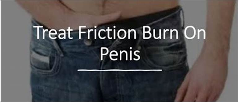 Friction burn on penis